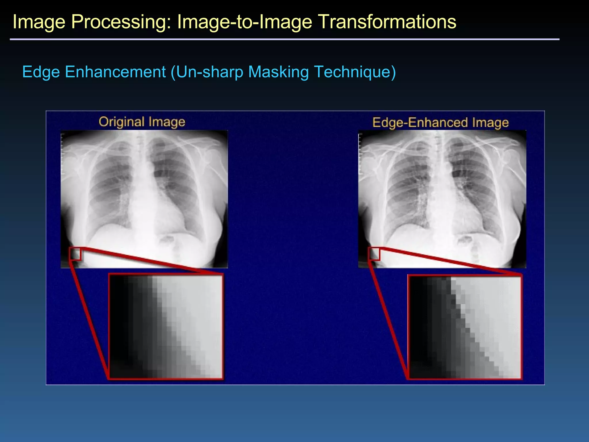 Image Processing: Image-to-Image Transformations Edge Enhancement (Un-sharp Masking Technique)  