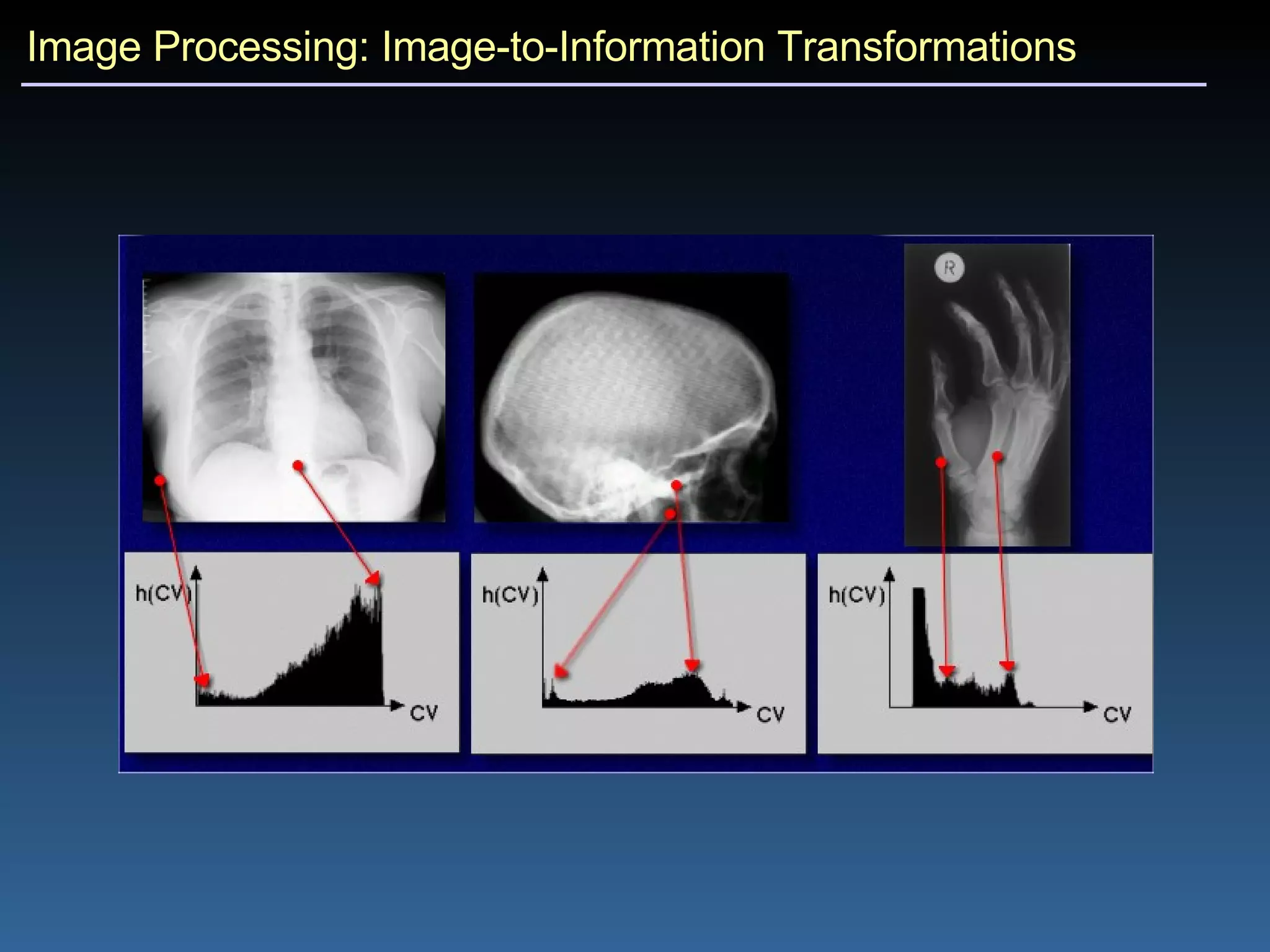 Image Processing: Image-to-Information Transformations 