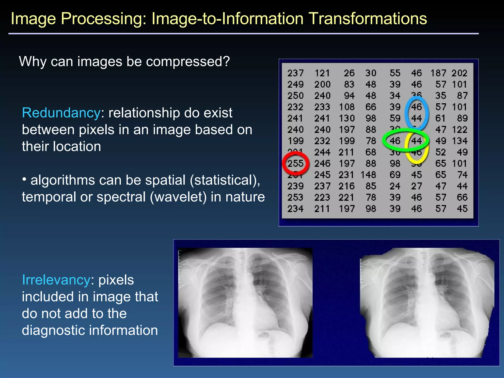 Image Processing: Image-to-Information Transformations Why can images be compressed?   Redundancy : relationship do exist between pixels in an image based on their location algorithms can be spatial (statistical), temporal or spectral (wavelet) in nature Irrelevancy : pixels included in image that do not add to the diagnostic information 
