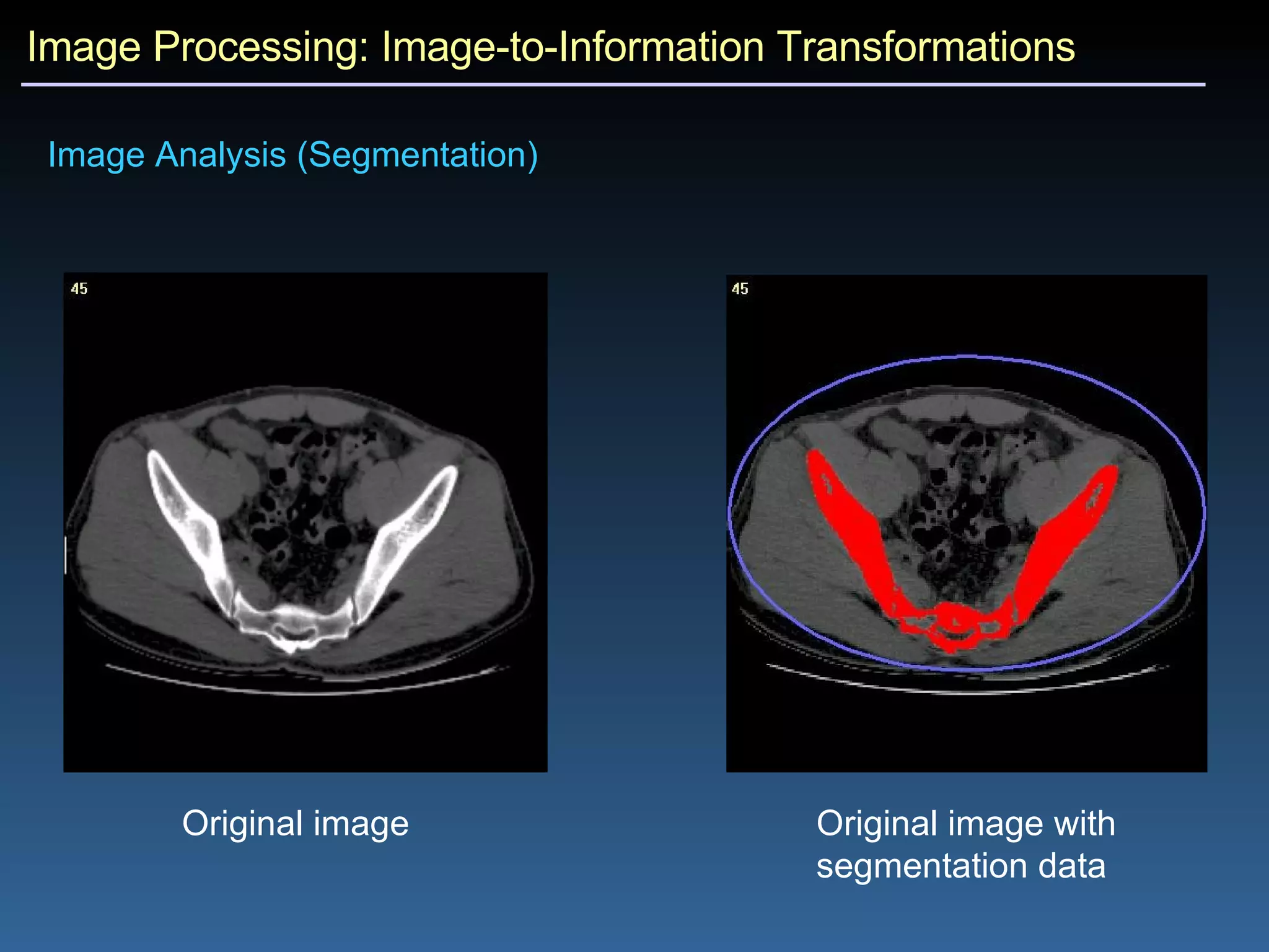 Image Processing: Image-to-Information Transformations Image Analysis (Segmentation) Original image Original image with segmentation data 