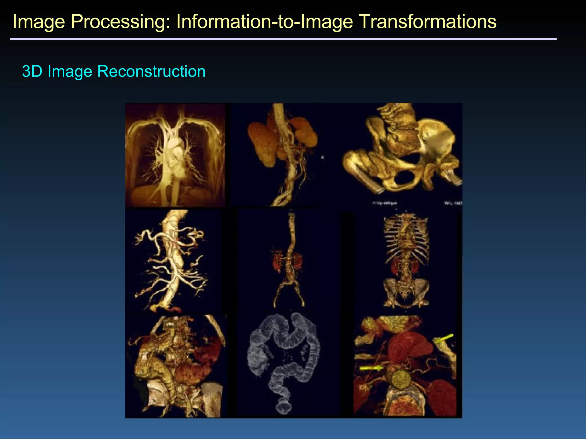 Image Processing: Information-to-Image Transformations 3D Image Reconstruction 