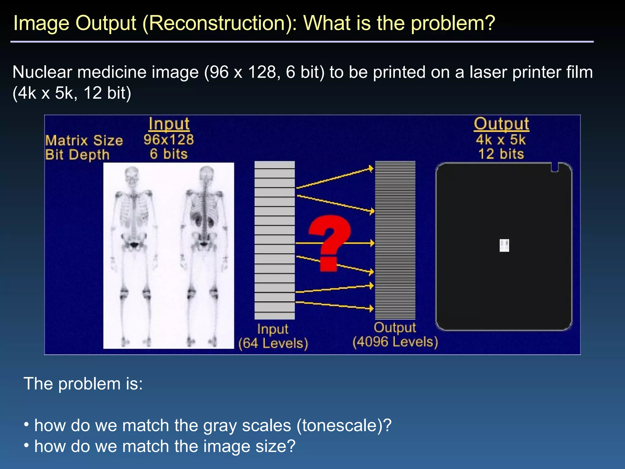 Image Output (Reconstruction): What is the problem? Nuclear medicine image (96 x 128, 6 bit) to be printed on a laser printer film (4k x 5k, 12 bit) The problem is: how do we match the gray scales (tonescale)? how do we match the image size? 