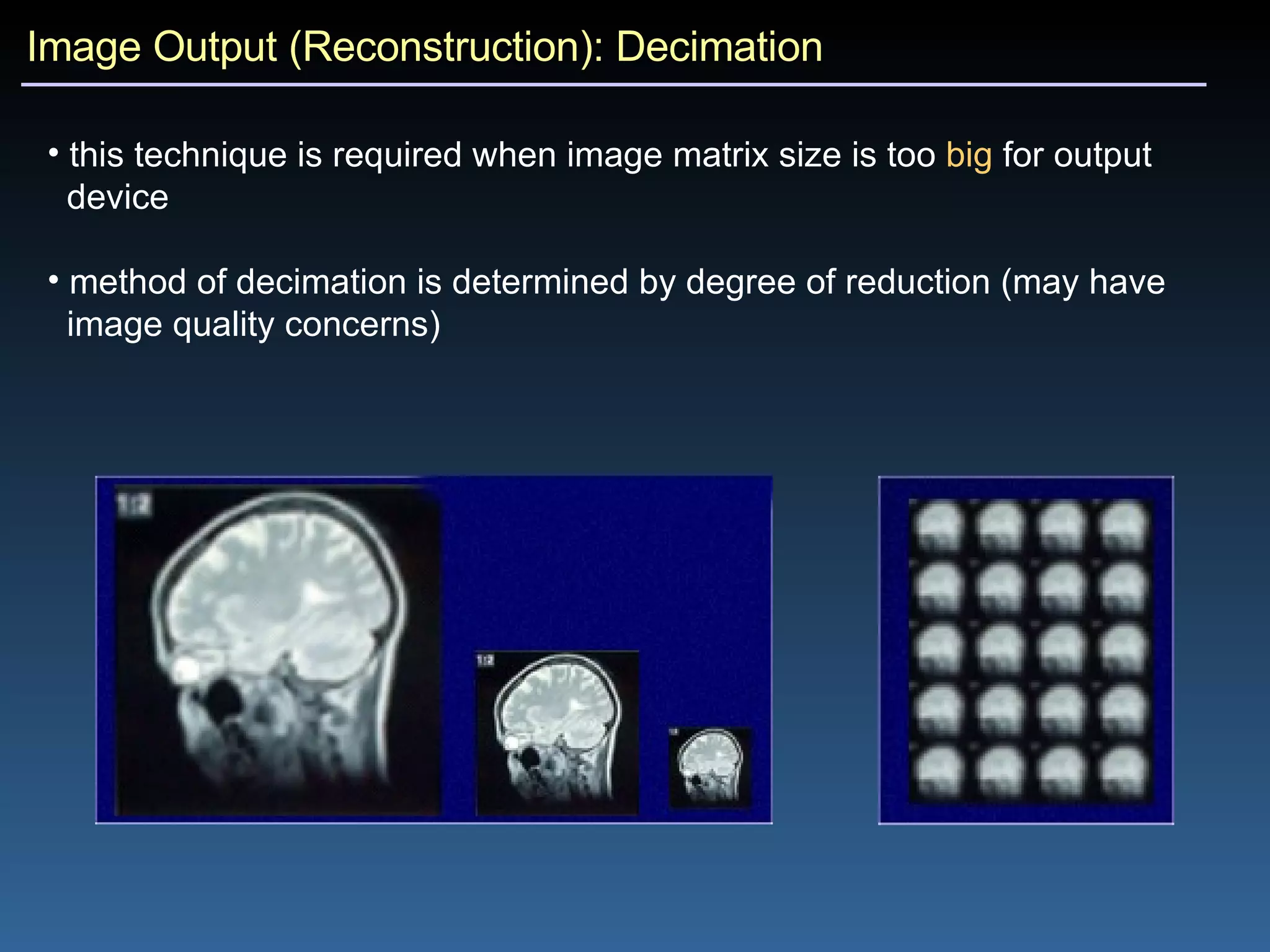 Image Output (Reconstruction): Decimation this technique is required when image matrix size is too  big  for output  device method of decimation is determined by degree of reduction (may have  image quality concerns) 