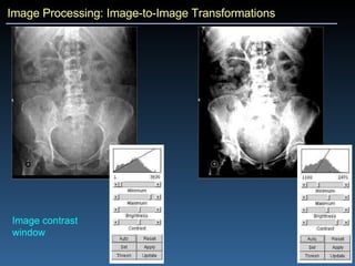 Image Processing: Image-to-Image Transformations Image contrast  window 