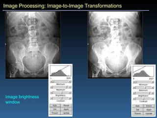 Image Processing: Image-to-Image Transformations Image brightness window 