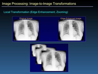 Image Processing: Image-to-Image Transformations Local Transformation (Edge Enhancement, Zooming)  