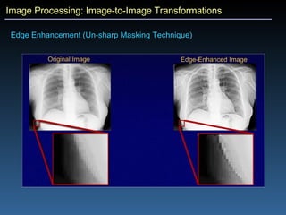 Image Processing: Image-to-Image Transformations Edge Enhancement (Un-sharp Masking Technique)  