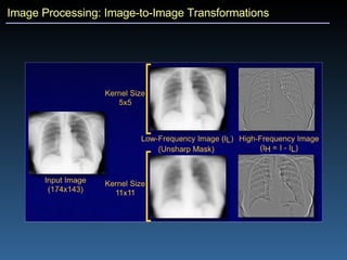 Image Processing: Image-to-Image Transformations 