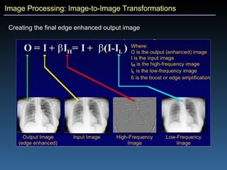 Image Processing: Image-to-Image Transformations Creating the final edge enhanced output image 
