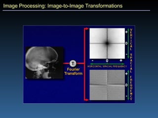 Image Processing: Image-to-Image Transformations 