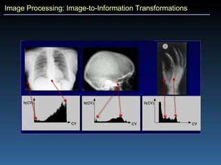 Image Processing: Image-to-Information Transformations 