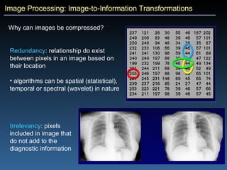 Image Processing: Image-to-Information Transformations Why can images be compressed?   Redundancy : relationship do exist between pixels in an image based on their location algorithms can be spatial (statistical), temporal or spectral (wavelet) in nature Irrelevancy : pixels included in image that do not add to the diagnostic information 