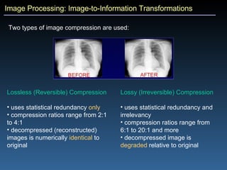 Image Processing: Image-to-Information Transformations Two types of image compression are used: Lossless (Reversible) Compression   uses statistical redundancy  only compression ratios range from 2:1 to 4:1 decompressed (reconstructed) images is numerically  identical  to original Lossy (Irreversible) Compression   uses statistical redundancy and irrelevancy compression ratios range from 6:1 to 20:1 and more decompressed image is  degraded  relative to original 
