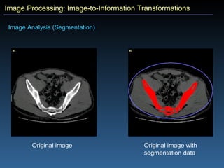 Image Processing: Image-to-Information Transformations Image Analysis (Segmentation) Original image Original image with segmentation data 