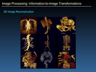 Image Processing: Information-to-Image Transformations 3D Image Reconstruction 