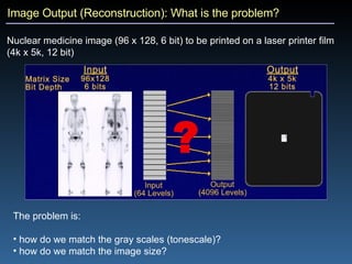 Image Output (Reconstruction): What is the problem? Nuclear medicine image (96 x 128, 6 bit) to be printed on a laser printer film (4k x 5k, 12 bit) The problem is: how do we match the gray scales (tonescale)? how do we match the image size? 