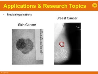 A. B. Shinde
Applications & Research Topics
• Medical Applications
55
Breast Cancer
Skin Cancer
 