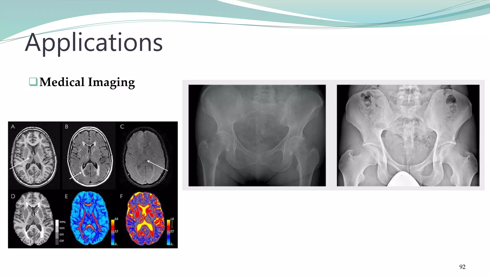 Medical Imaging Applications 92 