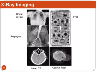 X-Ray Imaging
Cygnus loop
PCB
Chest
X-Ray
Head CT
Angiogram
15
 
