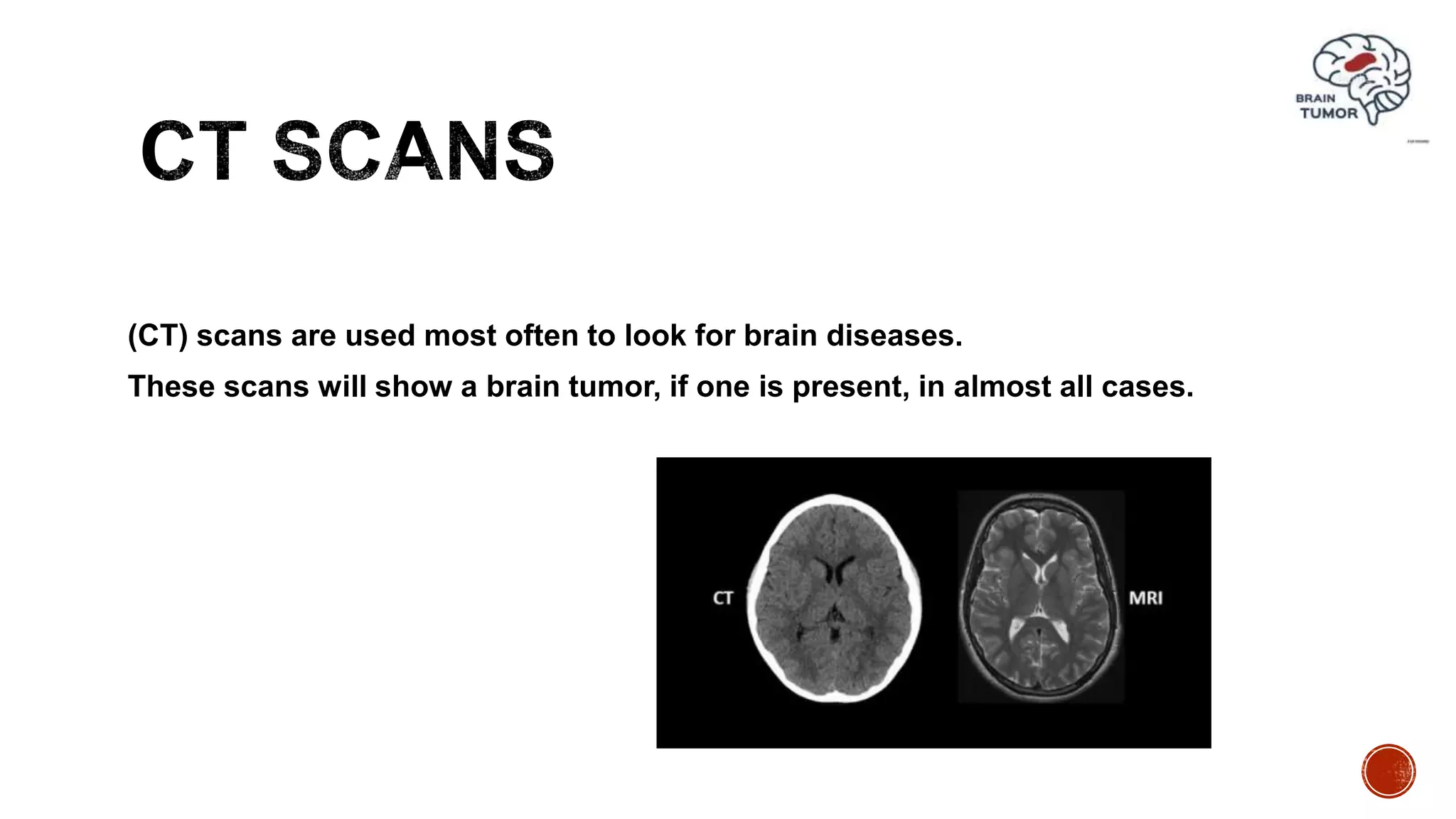 (CT) scans are used most often to look for brain diseases.
These scans will show a brain tumor, if one is present, in almost all cases.
 