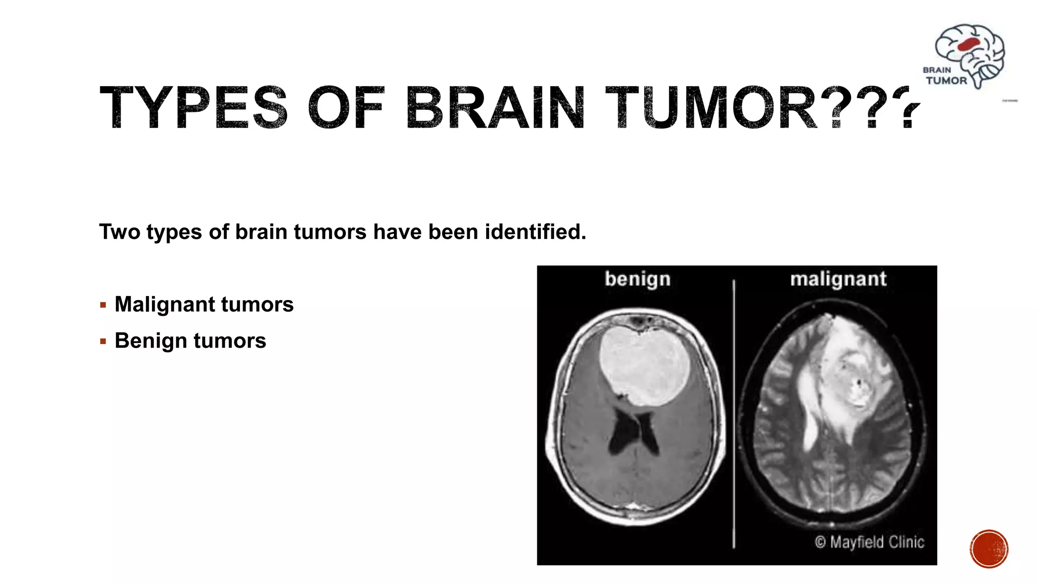 Two types of brain tumors have been identified.
 Malignant tumors
 Benign tumors
 