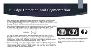 6. Edge Detection and Segmentation
 Edge detection and segmentation are two image-processing tools that can
be used to assist in automatically defining ROIs. They also are used for
classifying different types of tissue based on their radiotracer uptake and for
defining the body and lung contours for attenuation correction.
 Edge-detection algorithms work best with edges that are very clearly defined
as a result of a sharp boundary in radiotracer uptake. One of the most
common is the Laplacian technique. The 2-D Laplacian is defined by
 The goal of image segmentation is to group all pixels that have certain
defined characteristics. In nuclear medicine, this usually refers to pixels
that have a certain range of pixel intensities and thus a certain level
ofradiotracer uptake. The simplest method of segmentation is just to select
pixels having values within a specified range: A < p(x,y) < B.
 Because of image noise, this simple method rarely is sufficient for accurate
segmentation. More sophisticated algorithms that consider the underlying
resolution and noise properties of the images and that also seek clusters of
contiguous pixels usually are employed.
Fig.10 Series of images illustrating the segmentation
of the lungs on a transmission scan acquired on a
single-photon emission computed tomography
system.
 