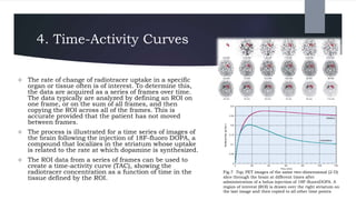 4. Time-Activity Curves
 The rate of change of radiotracer uptake in a specific
organ or tissue often is of interest. To determine this,
the data are acquired as a series of frames over time.
The data typically are analyzed by defining an ROI on
one frame, or on the sum of all frames, and then
copying the ROI across all of the frames. This is
accurate provided that the patient has not moved
between frames.
 The process is illustrated for a time series of images of
the brain following the injection of 18F-fluoro DOPA, a
compound that localizes in the striatum whose uptake
is related to the rate at which dopamine is synthesized.
 The ROI data from a series of frames can be used to
create a time-activity curve (TAC), showing the
radiotracer concentration as a function of time in the
tissue defined by the ROI.
Fig.7 Top, PET images of the same two-dimensional (2-D)
slice through the brain at different times after
administration of a bolus injection of 18F-fluoroDOPA. A
region of interest (ROI) is drawn over the right striatum on
the last image and then copied to all other time points.
 