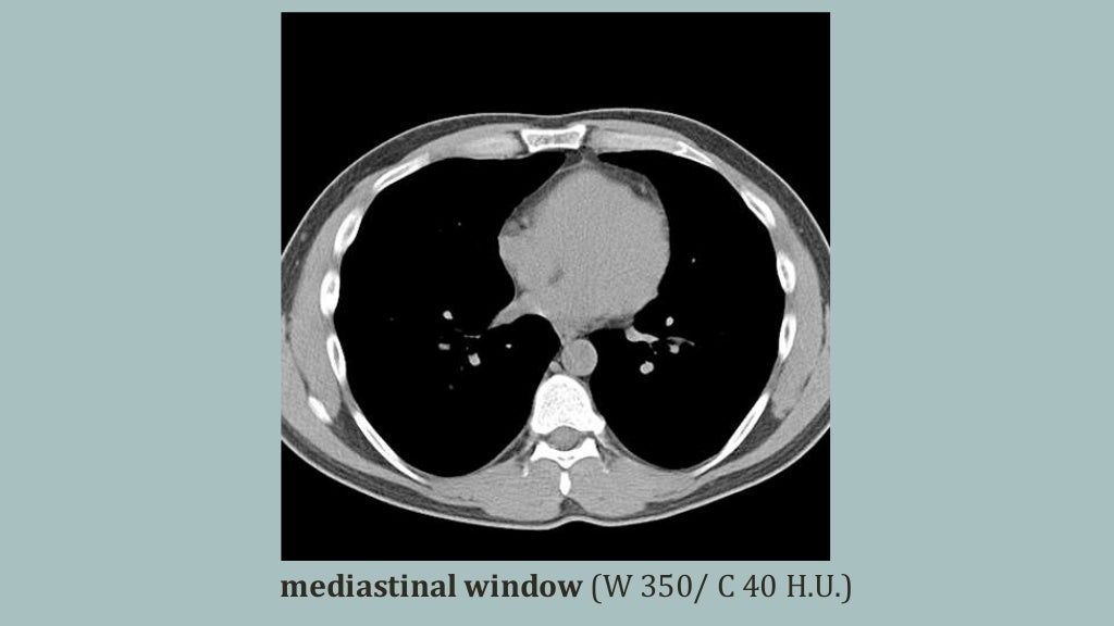 Image Quality Radiologic Imaging