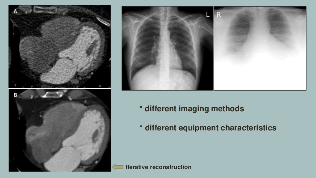 Image Quality Radiologic Imaging