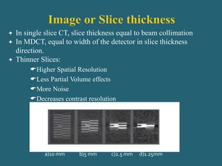  In single slice CT, slice thickness equal to beam collimation
 In MDCT, equal to width of the detector in slice thickness
direction.
 Thinner Slices:
Higher Spatial Resolution
Less Partial Volume effects
More Noise
Decreases contrast resolution
a)10 mm b)5 mm c)2.5 mm d)1.25mm
 