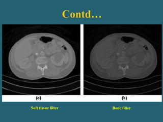 Soft tissue filter Bone filter
 