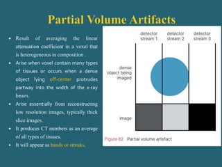  Result of averaging the linear
attenuation coefficient in a voxel that
is heterogeneous in composition .
 Arise when voxel contain many types
of tissues or occurs when a dense
object lying off-center protrudes
partway into the width of the x-ray
beam.
 Arise essentially from reconstructing
low resolution images, typically thick
slice images.
 It produces CT numbers as an average
of all types of tissues.
 It will appear as bands or streaks.
 