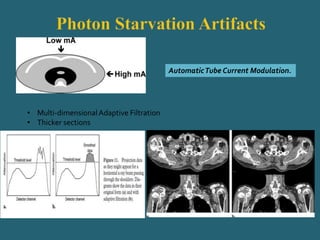 AutomaticTube Current Modulation.
• Multi-dimensionalAdaptive Filtration
• Thicker sections
 