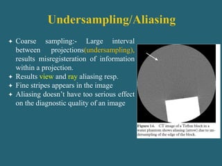  Coarse sampling:- Large interval
between projections(undersampling),
results misregisteration of information
within a projection.
 Results view and ray aliasing resp.
 Fine stripes appears in the image
 Aliasing doesn’t have too serious effect
on the diagnostic quality of an image
 