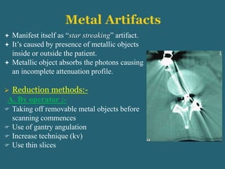  Manifest itself as “star streaking” artifact.
 It’s caused by presence of metallic objects
inside or outside the patient.
 Metallic object absorbs the photons causing
an incomplete attenuation profile.
 Reduction methods:-
A. By operator :-
 Taking off removable metal objects before
scanning commences
 Use of gantry angulation
 Increase technique (kv)
 Use thin slices
 