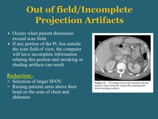  Occurs when patient dimension
exceed scan field.
 If any portion of the Pt. lies outside
the scan field of view, the computer
will have incomplete information
relating this portion and streaking or
shading artifacts can result.
Reduction:-
 Selection of larger SFOV.
 Raising patients arms above their
head on the scan of chest and
abdomen
 