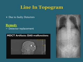  Due to faulty Detectors
Remedy
 Detector replacement
 