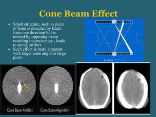  Small structure, such as piece
of bone is detected by beam
from one direction but is
missed by opposing beam
resulting inconsistency , leads
to streak artifact
 Such effect is more apparent
with larger cone angle or large
pitch
 