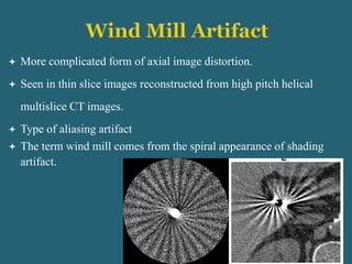  More complicated form of axial image distortion.
 Seen in thin slice images reconstructed from high pitch helical
multislice CT images.
 Type of aliasing artifact
 The term wind mill comes from the spiral appearance of shading
artifact.
 