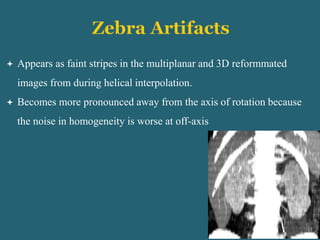  Appears as faint stripes in the multiplanar and 3D reformmated
images from during helical interpolation.
 Becomes more pronounced away from the axis of rotation because
the noise in homogeneity is worse at off-axis
 