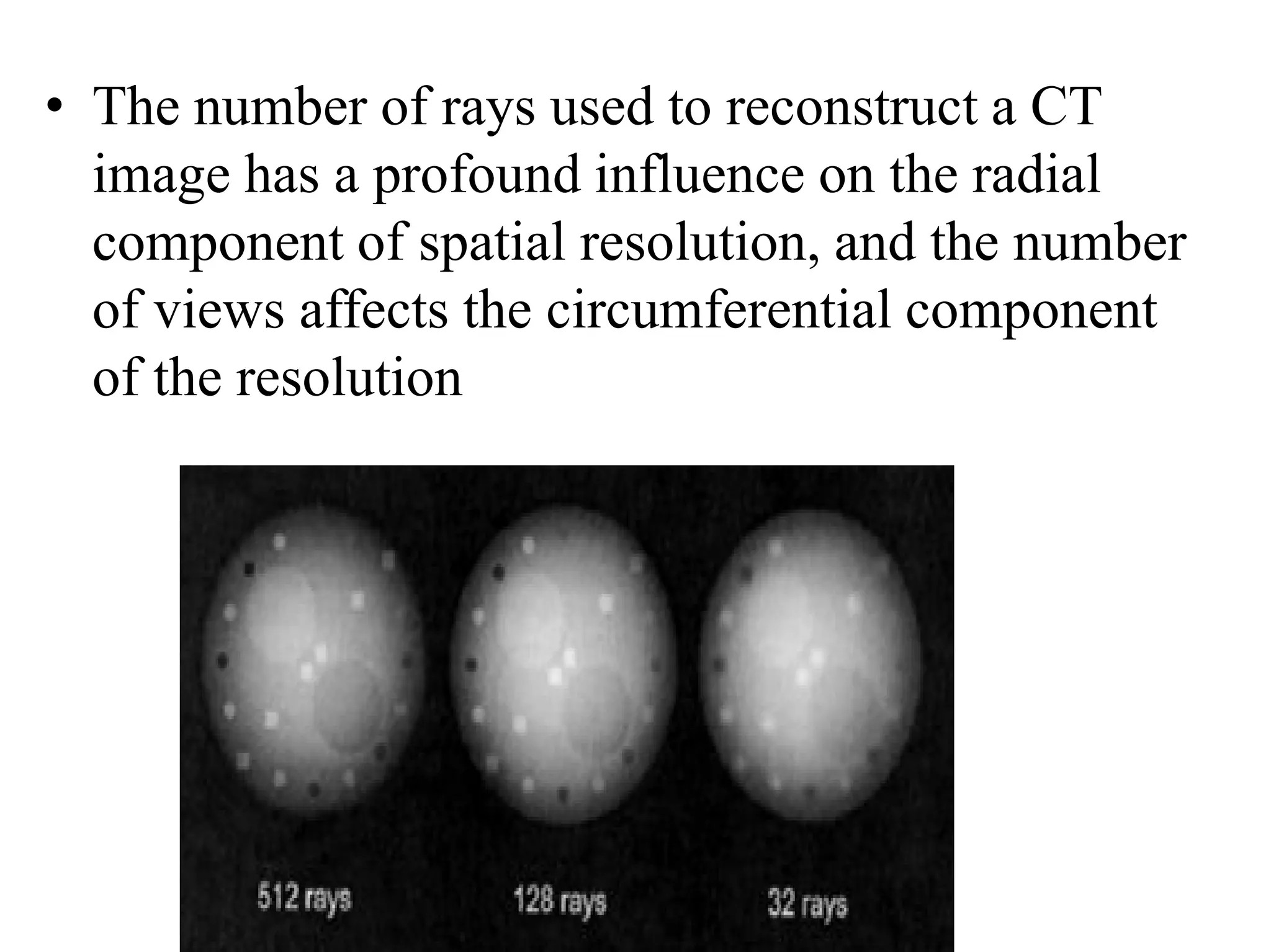 • The number of rays used to reconstruct a CT
image has a profound influence on the radial
component of spatial resolution, and the number
of views affects the circumferential component
of the resolution
 