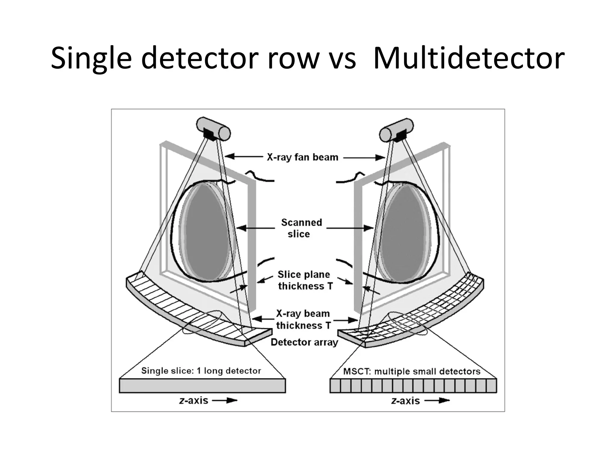 Single detector row vs Multidetector
 