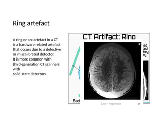 Image Reconstruction in radiography.pptx