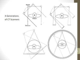 4 Generations
of CT Scanners
30
 