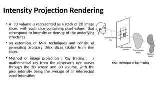 Mpr Volume Rendering IMAGE REFORMATION TECHNIQUES IN CT-SABBU.pptx