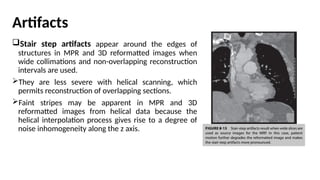 IMAGE REFORMATION TECHNIQUES IN CT-SABBU.pptx