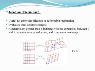 Jacoby Roth Deterministic Effects IMAGE REGISTRATION IN RADIOTHERAPY TREATMENT PLANNING | PPTX