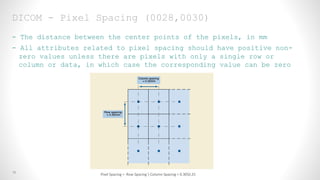 12
DICOM - Pixel Spacing (0028,0030)
- The distance between the center points of the pixels, in mm
- All attributes related to pixel spacing should have positive non-
zero values unless there are pixels with only a single row or
column or data, in which case the corresponding value can be zero
Pixel Spacing = Row Spacing  Column Spacing = 0.300.25
 