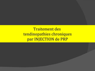 Traitement des
tendinopathies chroniques
  par INJECTION de PRP
 