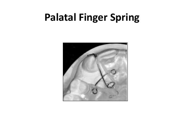Lee Spring Finger Palatal Finger Spring | Finger Injuries – CEMG
